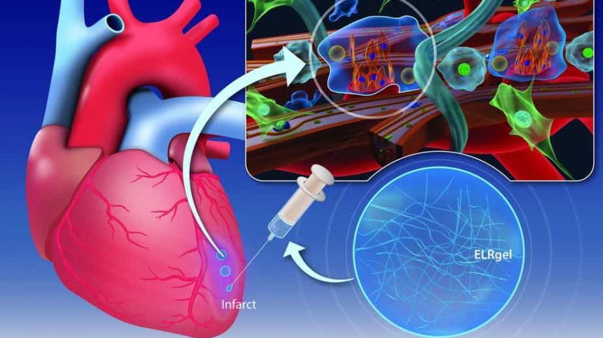 Researchers at NUIG develop gel to improve outcome after heart attacks