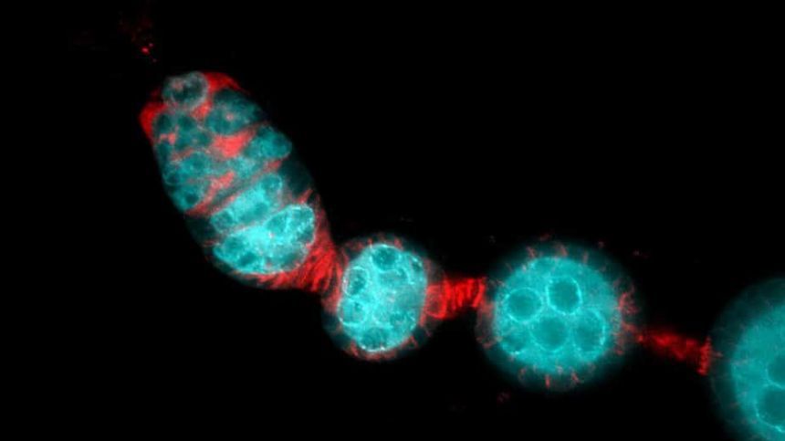 NUI Galway fruitfly study finds potential to improve human fertility