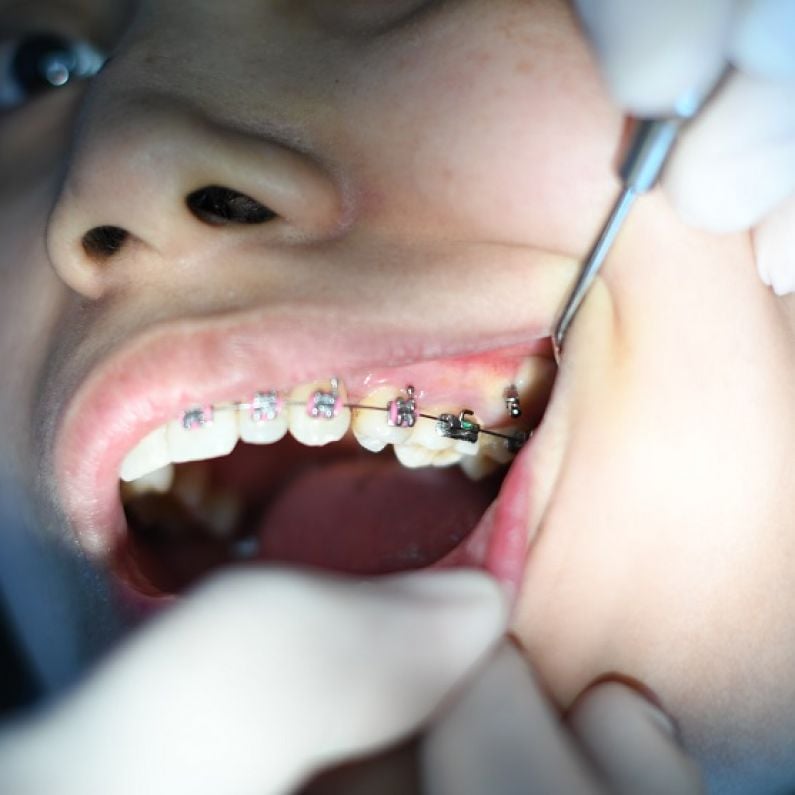 Emergency orthodontists resumes practice in Oranmore for patients of Ann Hahessy