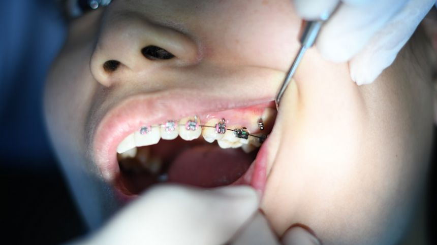 Emergency orthodontists resumes practice in Oranmore for patients of Ann Hahessy