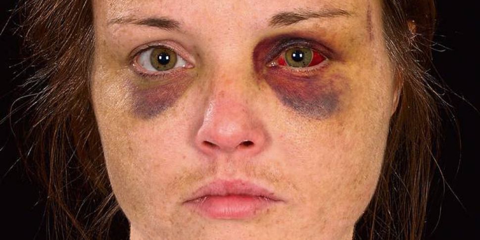 Domestic violence victim 