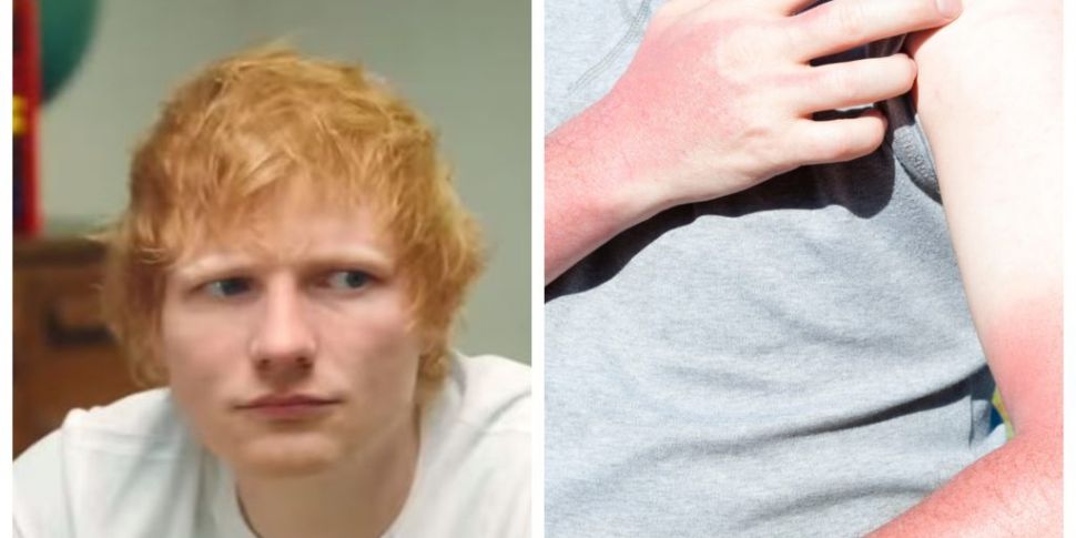 Ed Sheeran to launch a suncrea...