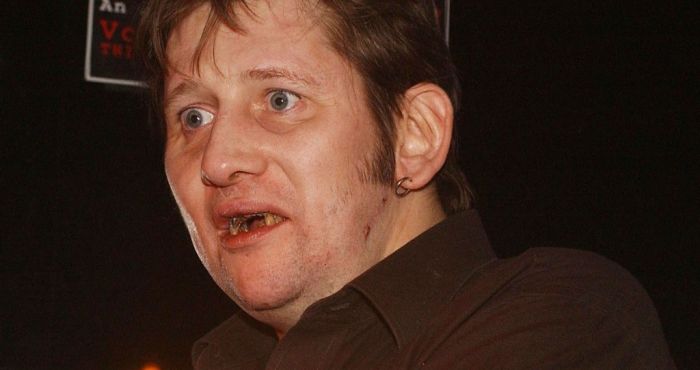 The Pogues' Shane MacGowan made a documentary about his new set of chompers