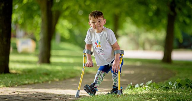 Five-year-old who lost both legs as a baby raises £1 million for ...