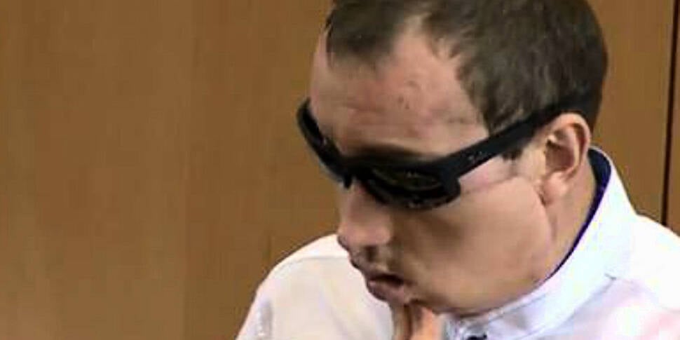 Face transplant patient thanks...