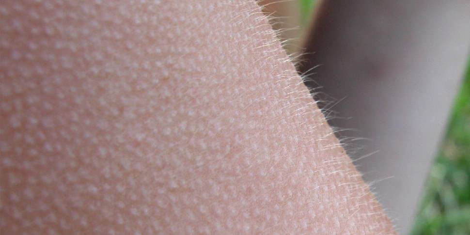 What are goosebumps?