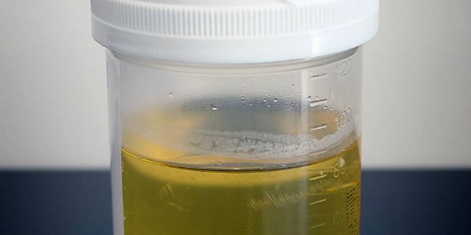 What is in Urine?