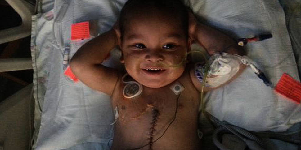 Boy in US undergoes five-organ...