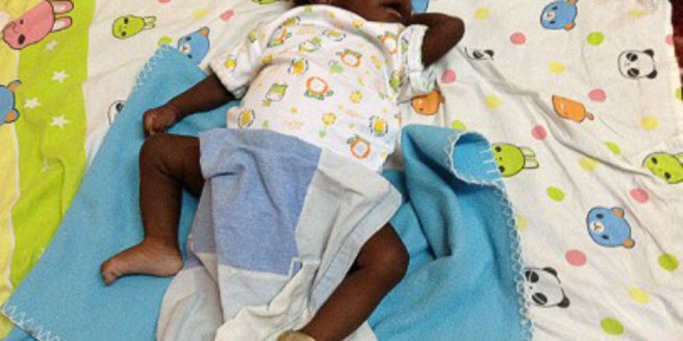 Baby born with eight limbs recovering after surgery | Newstalk