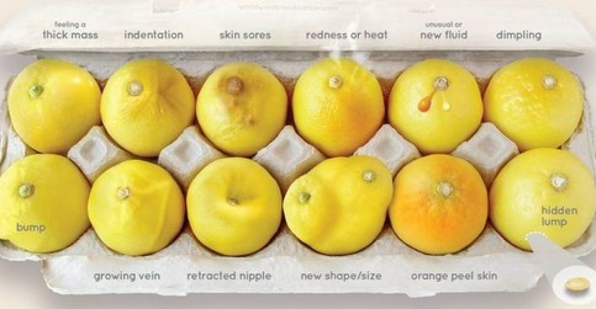 Lemon-inspired guide to breast cancer is a zest approach to early detection