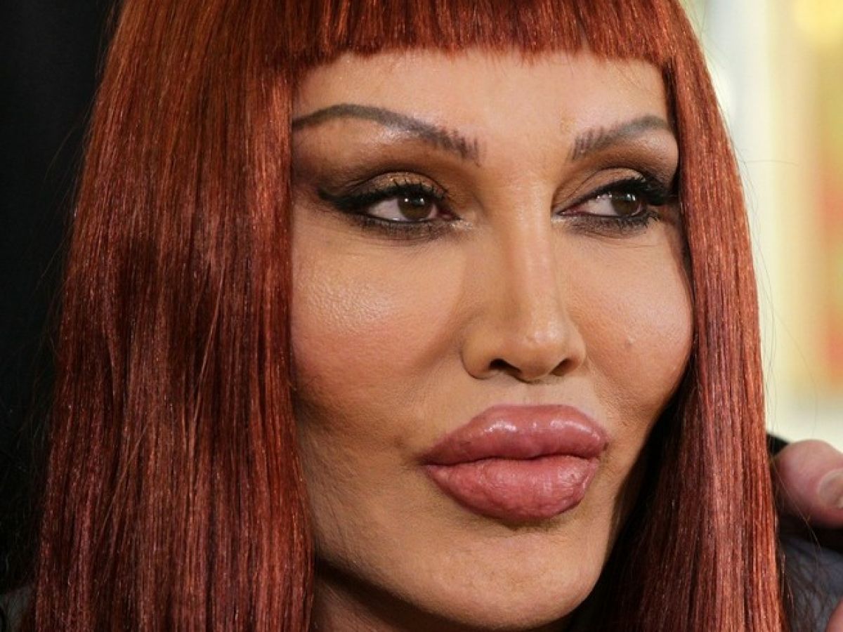 Pete Burns Dead: 'You Spin Me Round' Singer Dies at 57