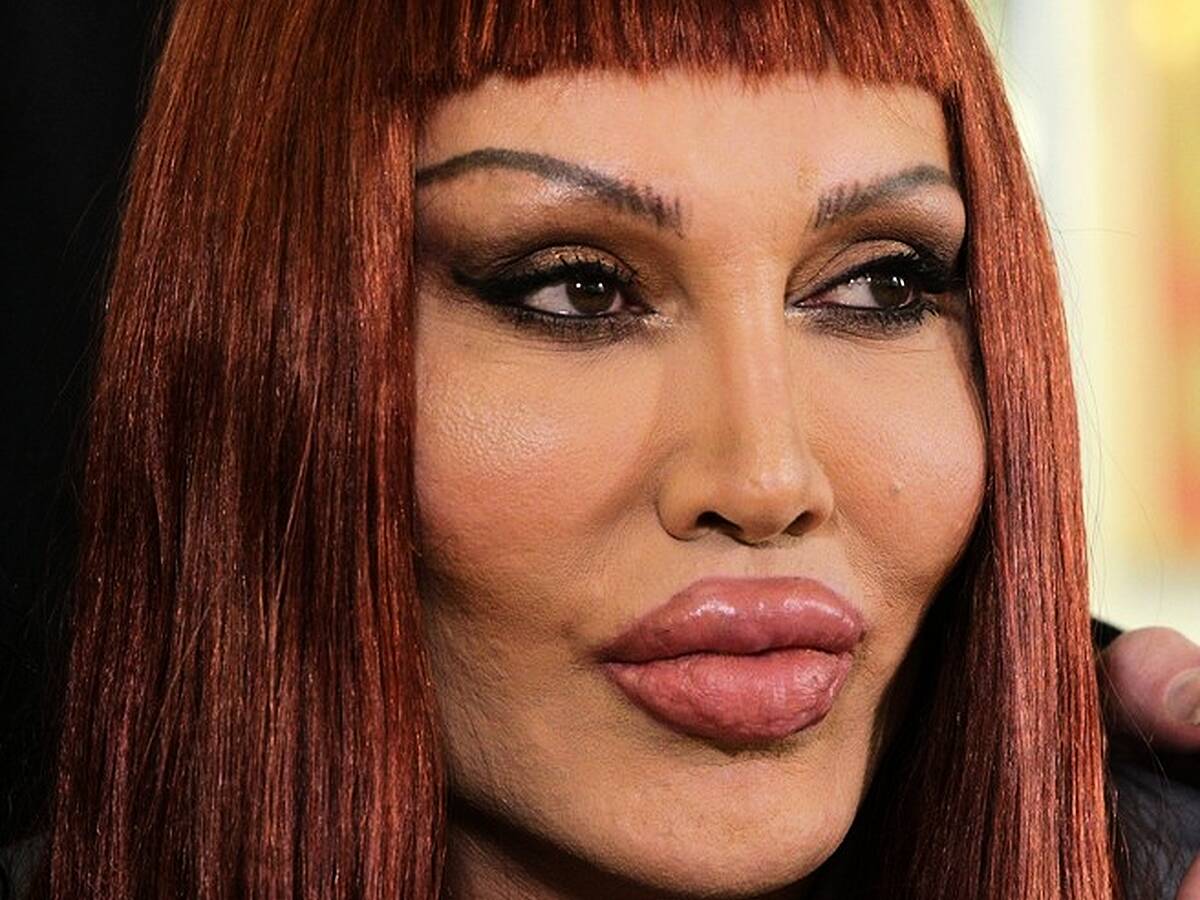 Pete Burns Dead: 'You Spin Me Round' Singer Dies at 57