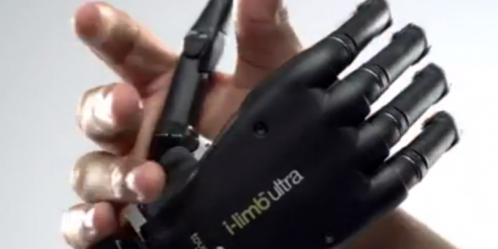 The Bionic Hand