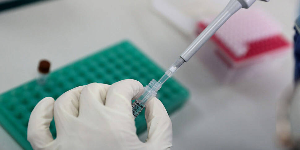 Morning top 5: COVID-19 cases;...