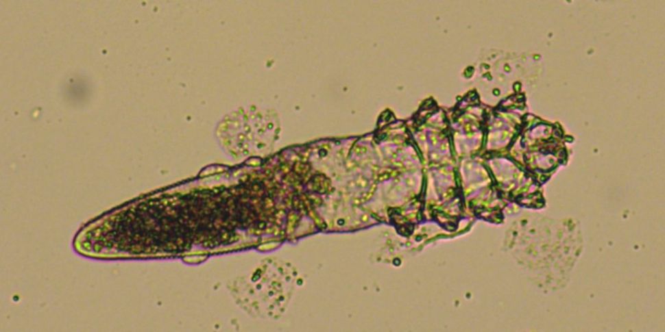 Demodex: The Animal That Lives...