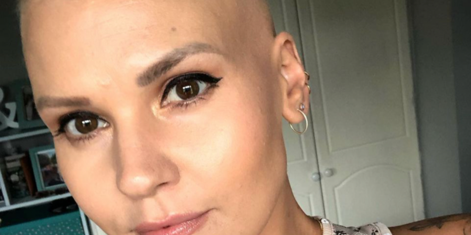 Living with Alopecia
