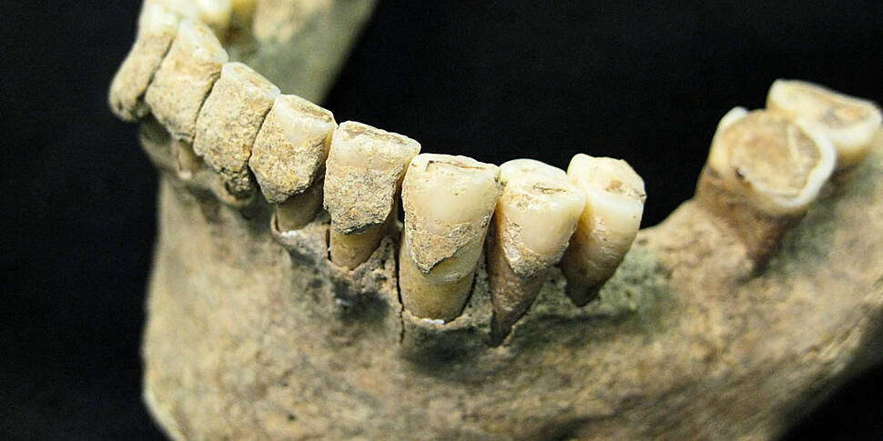 Dental Plaque: The Unexpected...