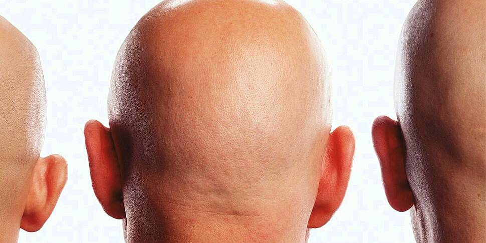 The Dating App for Bald People