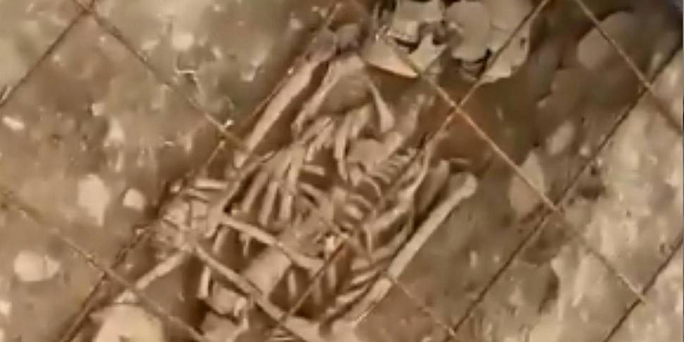 Viral video shows skeletal rem...