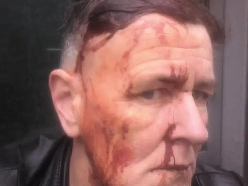 Two years jail for man who attacked Leitrim LGBT+ activist