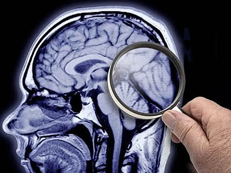 Campaign underway to improve neurology services in north west