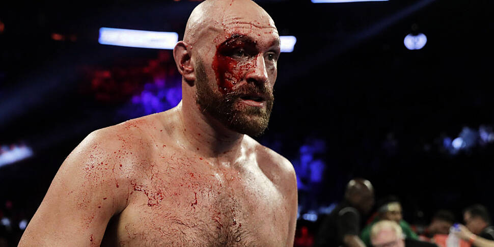 Andy Lee on Tyson Fury's cut |...