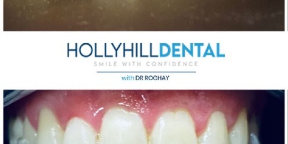 Win Teeth Whitening with Holly...