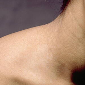 Ask the Expert: Dermatology - GoLoud Player