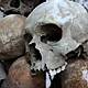 The Trouble With Our Skulls