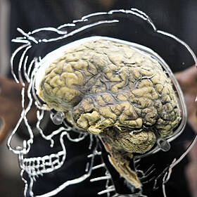 A Thousand Brains Image