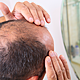 So You Think You're An Adult: My Partner is going bald, it looks awful