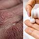 How To Manage Dry Skin This Winter