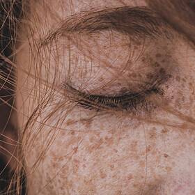 Do red haired people face prejudice? Image