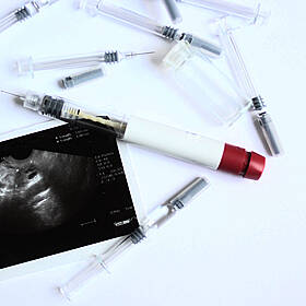 A new bill is proposed to give paid leave for those after a miscarriage and seeking fertility treatments Image