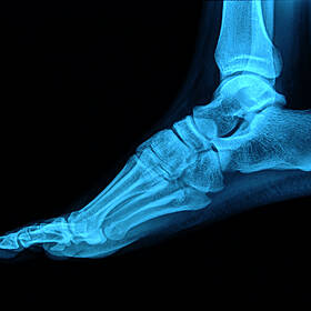 Ask The Expert: Niall Donohoe podiatrist Image