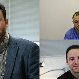 Everything You Need To Know About Hair Restoration Image