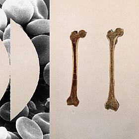 Match Made in Marrow Image