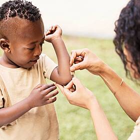 Body Bonanza: Bruises, scars and Band-Aids Image