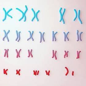 What is Down syndrome? Image