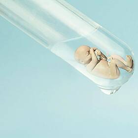 Show Ends Abruptly Over Womans Vile Comments About IVF Image