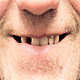 So You Think You're an Adult: I hate my fiancés teeth!