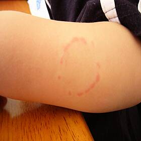 Dublin 15 Creche Under Fire By Angry Mum Because of Autistic Child in Room Image