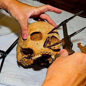 'Our goal is preservation' - Trading human bones Image