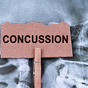Unsafe attitudes towards concussion are still prevalent Image