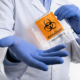 Lab leak theory resurfaces: what’s behind the new interest? Image