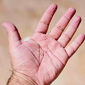 How Our Fingers Wrinkle in the Bath? Image