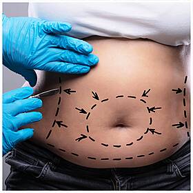 To Die For: Cosmetic Surgery in Turkey Image