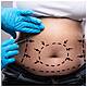To Die For: Cosmetic Surgery in Turkey