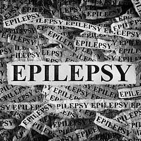 TD Eoghan Kenny about his epilepsy diagnosis Image