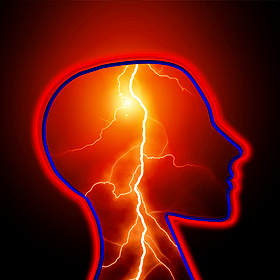 What it's like to live with epilepsy Image